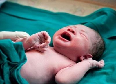علت تولد نوزاد سندرم داون، شایع ترین ناهنجـاری کروموزومـی