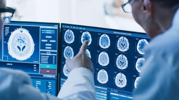 از بین بردن سلول های سرطان مغز با نانودارو امکان پذیر می گردد؟
